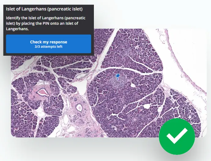 Image to show Slice feature - Ask Questions