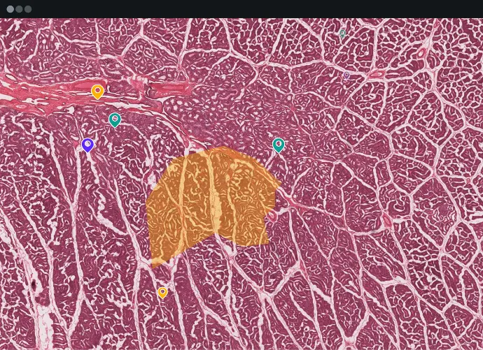 Image to show Slice feature - Engaging Group Activities
